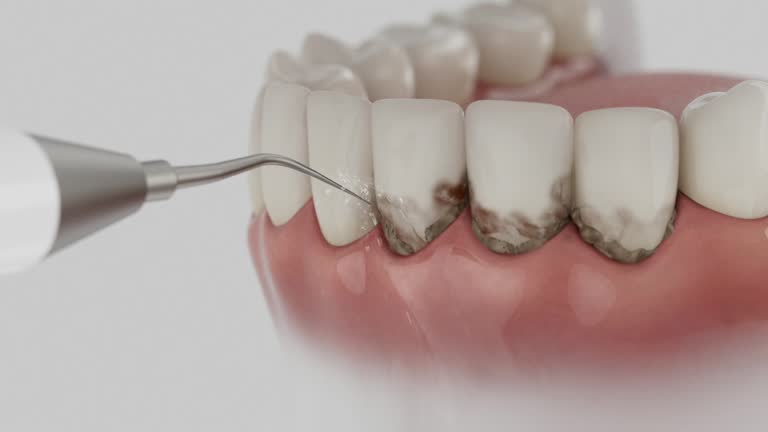 Reliable Teeth Cleaning And Checkup contractor in McLean County County, ND by Dentist Open Now